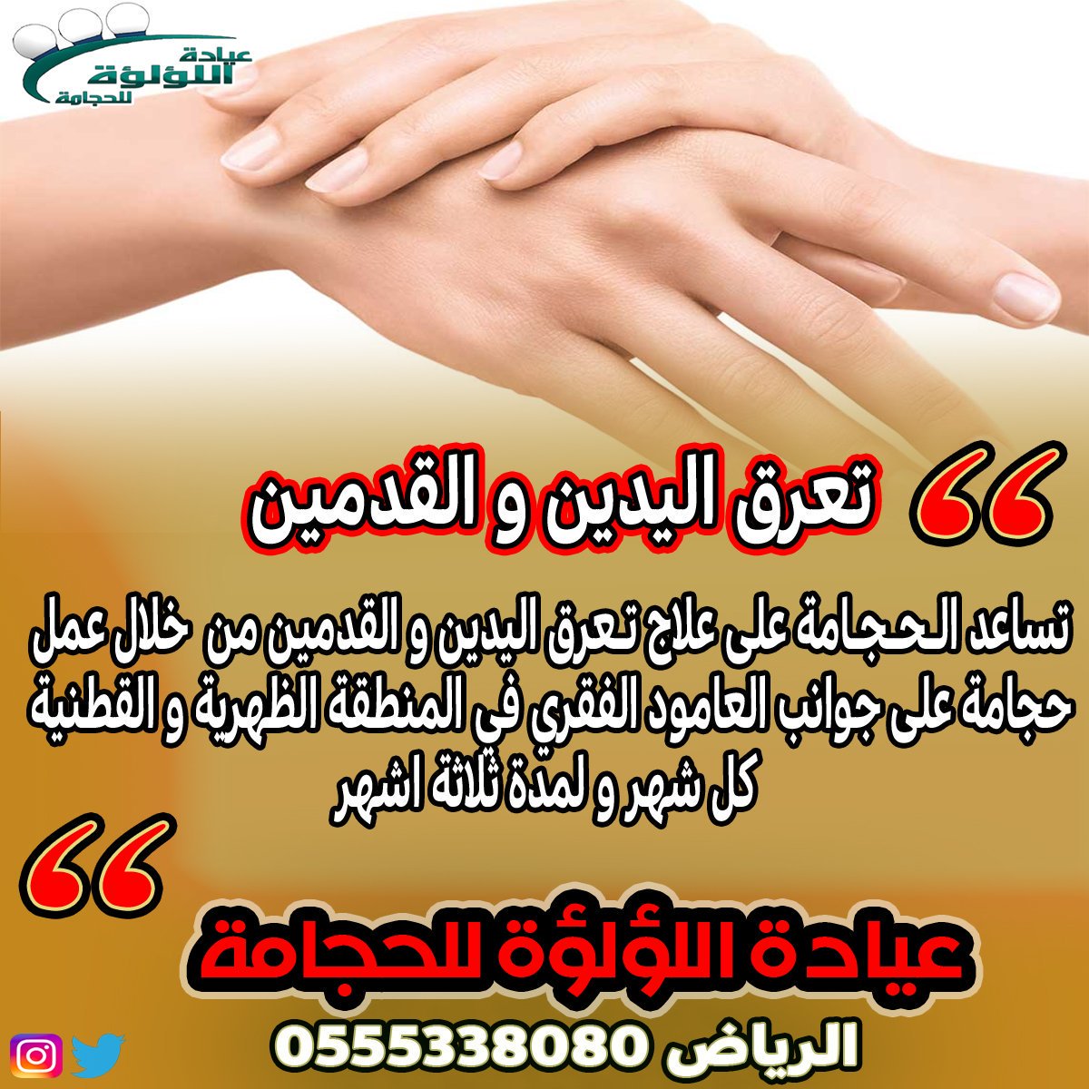 علاج تعرق اليدين والرجلين - اسبابه ووصفات تسهل التخلص منه 2263 15