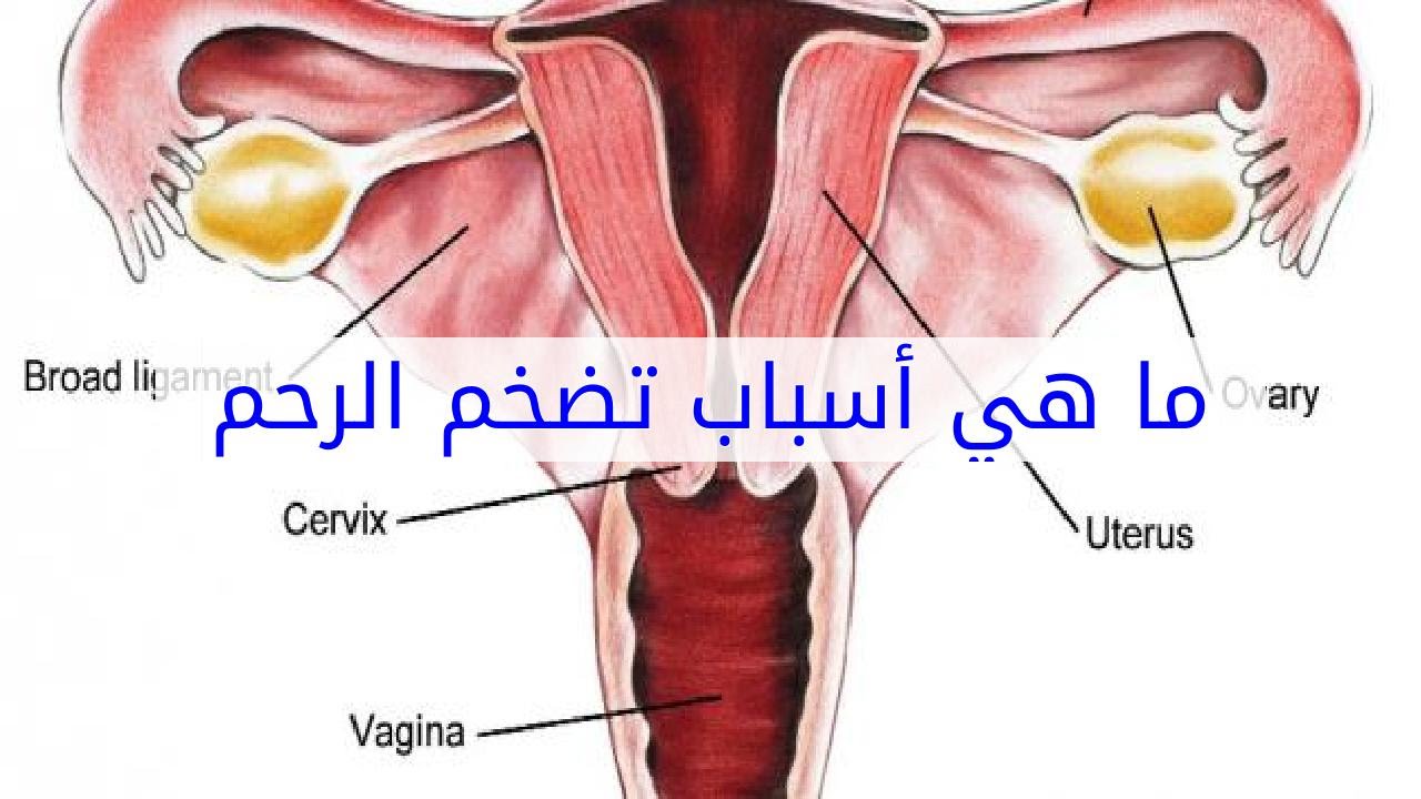 مشكل كثيرة للسيدات حلك عندي - اسباب انتفاخ الرحم 6606