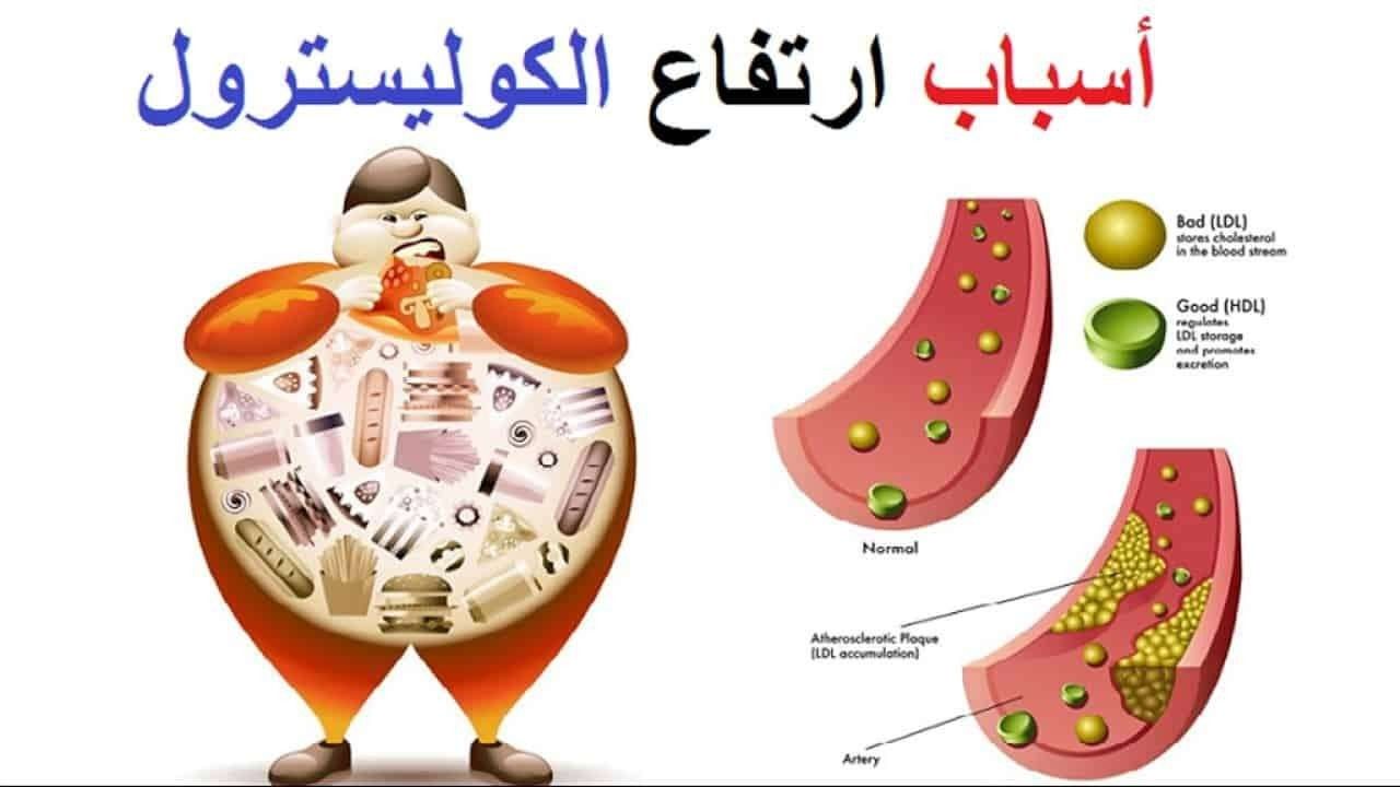 اعراض الكولسترول المرتفع , بسبب كتير من المشاكل هقلك عليه