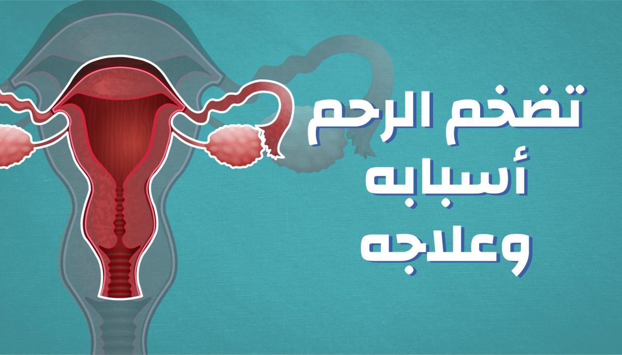 مشكل كثيرة للسيدات حلك عندي - اسباب انتفاخ الرحم 6606 2