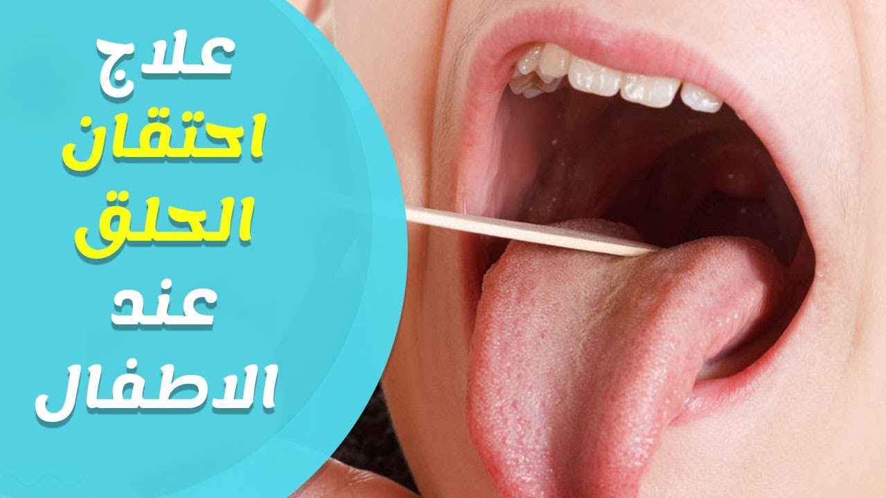 علاج اللحمية عند الاطفال بالاعشاب - تعرفي علي وصفة لعلاج اللحمية بدون جراحة 1598 3