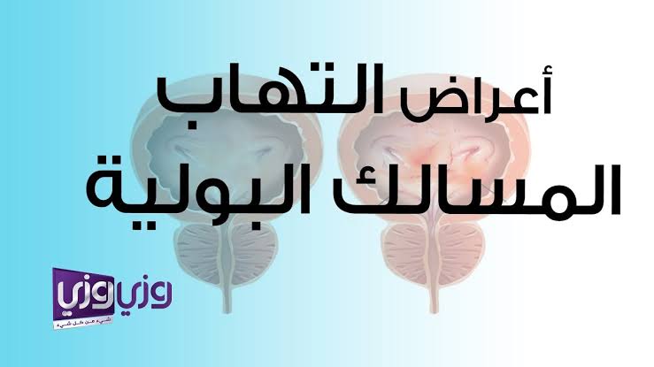 علاج التهاب المسالك البولية للرجال , اعراض التهاب المسالك البوليه الذكوريه وعلاجها