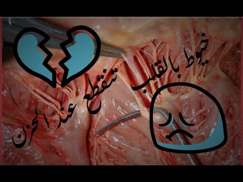 صورة قلب حزين - هل الحزن يمرض القلب ويكسره 2323