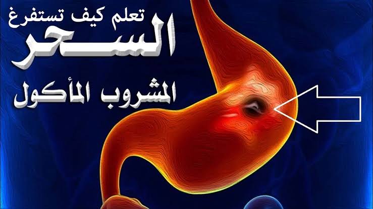 علاج التوكال بالرقية الشرعية , التوكال واثره علي المريض