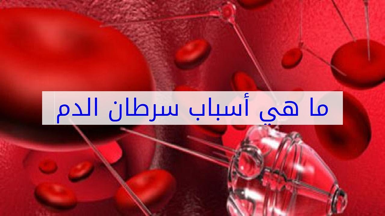 ماهي اسباب السرطان ، طرق علاجه 2687 3