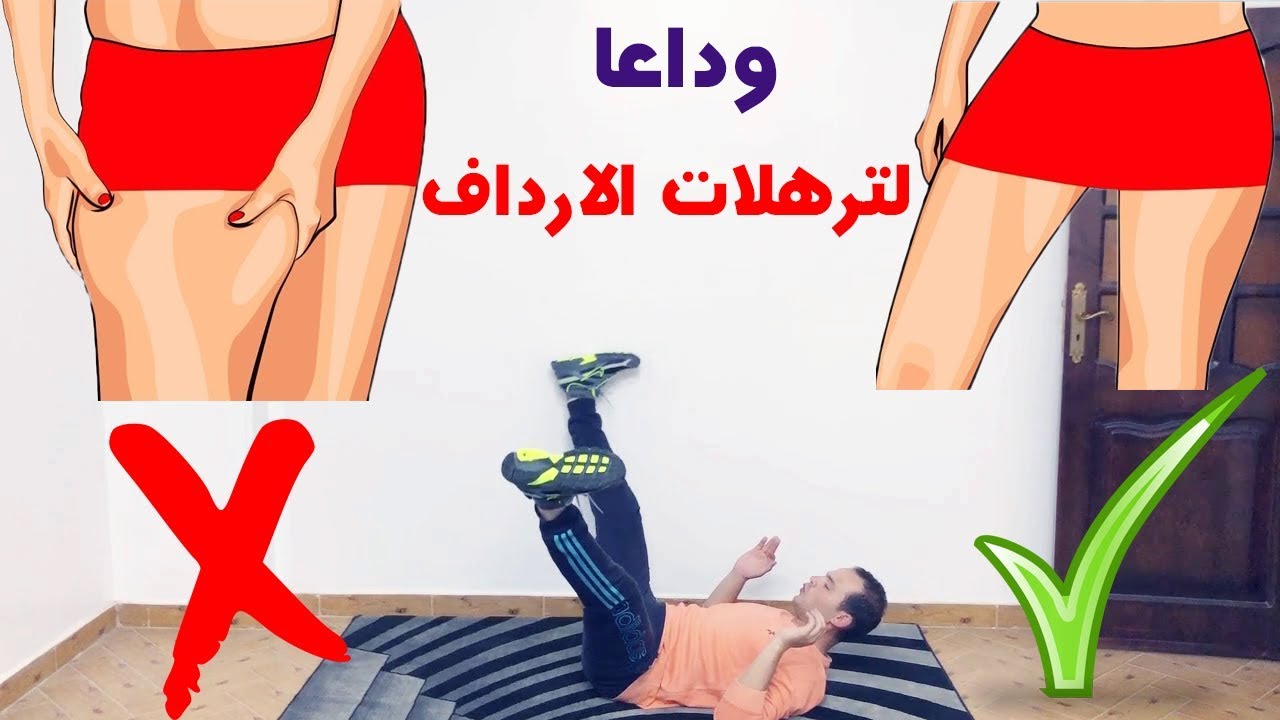 علاج الترهلات الارداف , طريقه شد الترهلات