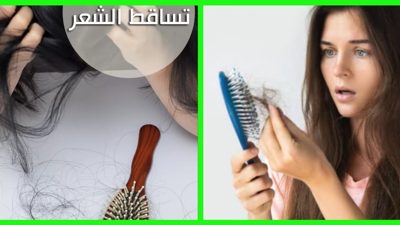 الشعر مشاكله كتيره وحلل له عندي، كيف اتخلص من تساقط الشعر 6398 1