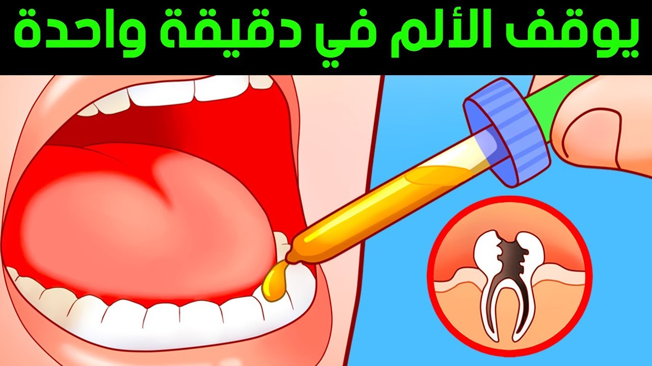 علاج وجع الاسنان للحامل - وصفات طبيعية وفعالة للقضاء على الم الاسنان 6592 2