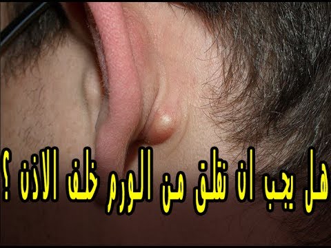 حبوب خلف الاذن - اسباب ظهور حبوب وورم خلف الاذن 2442 2