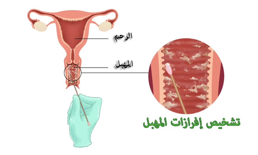 اسباب نزول الدم من المهبل للعذراء - اسرار نزول الدم من المهبل 319